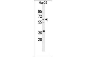 Image no. 1 for anti-24-Dehydrocholesterol Reductase (DHCR24) (Middle Region) antibody (ABIN358015) (Seladin 1 Antikörper  (Middle Region))