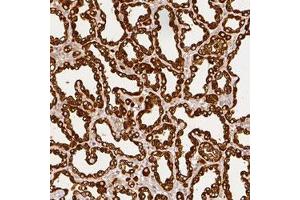 Immunohistochemical staining (Formalin-fixed paraffin-embedded sections) of human lactating breast with CSN2 polyclonal antibody  shows strong cytoplasmic positivity in glandular cells.