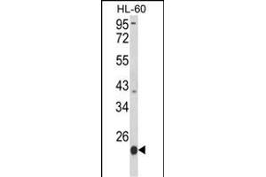 Western blot analysis of PSMB9 Antibody (C-term) (ABIN652496 and ABIN2842334) in HL-60 cell line lysates (35 μg/lane).