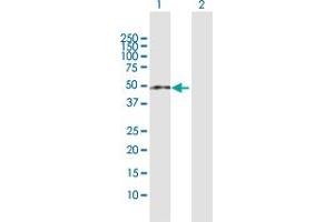 Western Blot analysis of ZCCHC11 expression in transfected 293T cell line by ZCCHC11 MaxPab polyclonal antibody. (ZCCHC11 Antikörper  (AA 1-309))