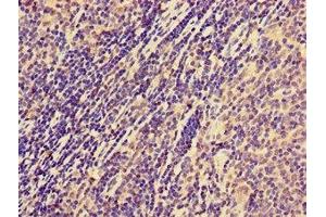 Immunohistochemistry of paraffin-embedded human lymph node tissue using ABIN7161071 at dilution of 1:100 (NCR1 Antikörper  (AA 121-230))