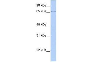 WB Suggested Anti-ZFP64 Antibody Titration:  0. (ZFP64 Antikörper  (N-Term))