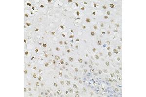Immunohistochemistry (IHC) image for anti-SET Nuclear Oncogene (SET) (AA 146-277) antibody (ABIN6147629)