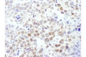 Immunohistochemistry (IHC) image for anti-Enhancer of Zeste Homolog 2 (EZH2) (AA 696-746) antibody (ABIN7450991) (EZH2 Antikörper  (AA 696-746))