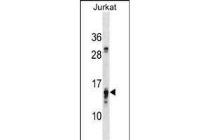 PFDN4 Antibody (N-term) (ABIN1539356 and ABIN2850409) western blot analysis in Jurkat cell line lysates (35 μg/lane). (PFDN4 Antikörper  (N-Term))