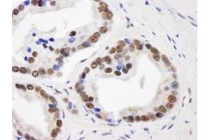 Immunohistochemistry (IHC) image for anti-General Transcription Factor III (GTF2I) (C-Term) antibody (ABIN7448970) (GTF2I Antikörper  (C-Term))