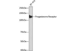 Progesterone Receptor Antikörper