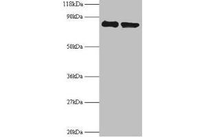 Western blot All lanes: RPS10 antibody at 2 μg/mL Lane 1: EC109 whole cell lysate Lane 2: 293T whole cell lysate Secondary Goat polyclonal to rabbit IgG at 1/15000 dilution Predicted band size: 19 kDa Observed band size: 80 kDa (RPS1 (AA 4-165) Antikörper)