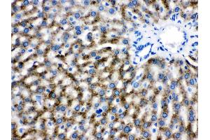 Catalase was detected in paraffin-embedded sections of rat liver tissues using rabbit anti- Catalase Antigen Affinity purified polyclonal antibody (Catalog # ) at 1 µg/mL. (Catalase Antikörper  (AA 344-527))