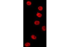 ABIN6277154 staining  HT29 cells by IF/ICC. (IRF3 Antikörper  (C-Term))