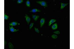 Immunofluorescence staining of A549 cells with ABIN7175225 at 1:50, counter-stained with DAPI. (ATP6V1A Antikörper  (Catalytic Subunit A))