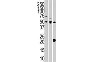 The STYK1 polyclonal antibody  is used in Western blot to detect STYK1 in 293 (left) , CEM (center) , and mouse kidney (right) cell line and tissue lysates. (STYK1 Antikörper  (N-Term))