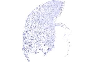 CK17 is usually absent in normal squamous epithelium