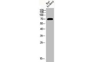 Western Blot analysis of RAT-kidney cells using Acetyl-HSP70 (K246) Polyclonal Antibody (HSP70 1A Antikörper  (acLys246))