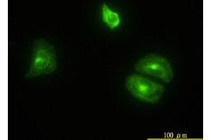 Image no. 4 for anti-Clathrin, Light Chain B (CLTB) (AA 1-212) antibody (ABIN598618) (CLTB Antikörper  (AA 1-212))