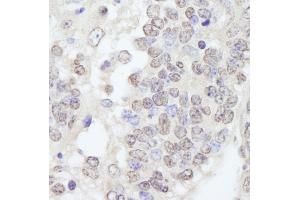 Immunohistochemistry (IHC) image for anti-Tripartite Motif Containing 33 (TRIM33) (C-Term) antibody (ABIN7448843) (TRIM33 Antikörper  (C-Term))