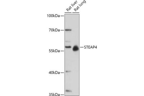 STEAP4 抗体  (AA 1-100)