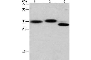 Western Blot analysis of Hela cell, Mouse brain and heart tissue using CAPZA2 Polyclonal Antibody at dilution of 1:650 (CAPZA2 Antikörper)