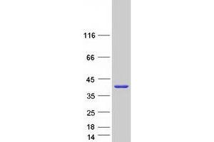 SULT1A4 Protein (Transcript Variant 1) (Myc-DYKDDDDK Tag)