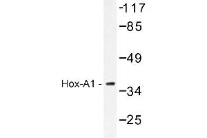 Image no. 1 for anti-Homeobox A1 (HOXA1) antibody (ABIN272197) (HOXA1 Antikörper)