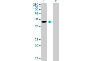 Western Blotting (WB) image for anti-Proteasome (Prosome, Macropain) 26S Subunit, ATPase, 3 (PSMC3) (AA 1-439) antibody (ABIN519389)