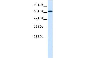 WB Suggested Anti-PSIP1 Antibody Titration:  0. (PSIP1 Antikörper  (Middle Region))