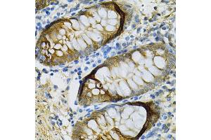 Immunohistochemistry of paraffin-embedded human colon using SELENBP1 Antibody. (SELENBP1 Antikörper)