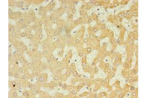 Immunohistochemistry of paraffin-embedded human liver tissue using ABIN7174641 at dilution of 1:100 (UGT2B4 Antikörper  (AA 281-481))