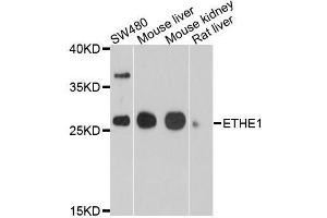 Western blot analysis of extracts of various cell lines, using ETHE1 antibody. (ETHE1 Antikörper  (AA 8-245))