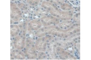 IHC-P analysis of Mouse Kidney Tissue, with DAB staining.