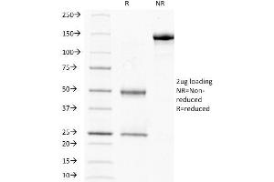 SDS-PAGE Analysis Purified HCG-beta Mouse Monoclonal Antibody (HCGb/211). (CGB Antikörper)