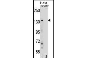 Western blot analysis of anti-JMJD3 Center Pab (AP1022c) in Hela cell line lysates. (Kdm6b Antikörper  (AA 954-987))