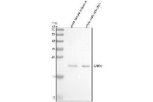 Western blot analysis of RAB10 using anti-RAB10 antibody (AZQ6DGV5).