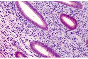Human Uterus: Formalin-Fixed, Paraffin-Embedded (FFPE) (ATG16L1 Antikörper  (Internal Region))