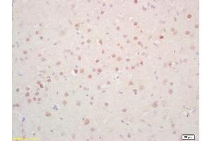 Formalin-fixed and paraffin embedded rat brain labeled with Rabbit Anti Phosphoserine/threonine/tyrosine Polyclonal Antibody, Unconjugated (ABIN1385069) at 1:200 followed by conjugation to the secondary antibody and DAB staining (Phosphoserine/Phosphothreonine/Phosphotyrosine (phosphorylated) Antikörper)