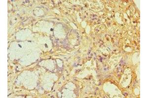 Immunohistochemistry of paraffin-embedded human gallbladder tissue using ABIN7144783 at dilution of 1:100 (Ataxin 1 Antikörper  (AA 586-815))