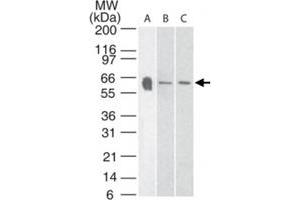 Western blot analysis of Htr3a in A) human, B) mouse and C) rat brain tissue lysate using Htr3a polyclonal antibody  at 3 ug/mL . (Serotonin Receptor 3A Antikörper  (AA 21-36))