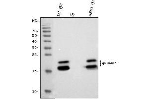 Western blot analysis of Alpha A Crystallin using anti-Alpha A Crystallin antibody (ABIN7599031).