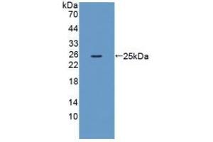 Detection of Recombinant XCR1, Mouse using Polyclonal Antibody to Chemokine C-Motif Receptor 1 (XCR1) (XCR1 Antikörper  (AA 244-322))