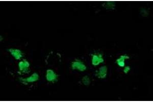 Anti-DSTN mouse monoclonal antibody (ABIN2454392) immunofluorescent staining of COS7 cells transiently transfected by pCMV6-ENTRY DSTN (RC203419). (Destrin Antikörper)