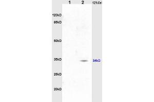 L1 rat liver, L2 rat brain lysates probed (ABIN687217) at 1:200 in 4 °C. (MTHFR Antikörper  (AA 165-300))