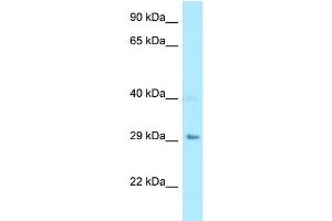 WB Suggested Anti-CA7 Antibody Titration: 1. (CA7 Antikörper  (Middle Region))