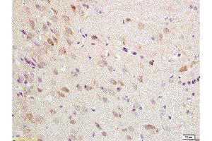 Formalin-fixed and paraffin embedded rat brain tissue labeled with Anti-ChRM1/Acetylcholine receptor(M1) Polyclonal Antibody, Unconjugated  at 1:200 followed by conjugation to the secondary antibody, (SP-0023), and DAB staining