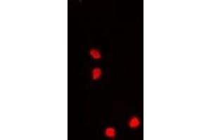 Immunofluorescence (IF) image for anti-Guanine Nucleotide Binding Protein-Like 3 (Nucleolar) (GNL3) antibody (ABIN7307830)