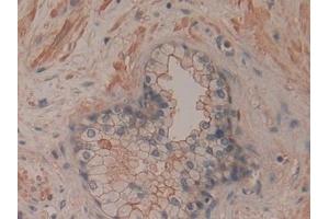 Detection of CD200 in Human Prostate Tissue using Polyclonal Antibody to Cluster Of Differentiation 200 (CD200) (CD200 Antikörper  (AA 31-232))