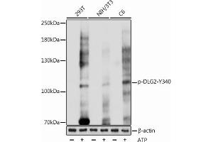 Western blot analysis of extracts of various cell lines, using Phospho-PSD93/chapsyn-110/DLG2-Y340 antibody (ABIN7266792) at 1:1000 dilution. (DLG2 Antikörper  (pTyr340))