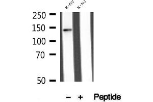Western blot analysis of extracts of K-562 cells, using MLXIP antibody. (MLXIP Antikörper  (N-Term))