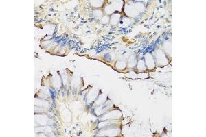 Immunohistochemistry of paraffin-embedded human colon using CRTAP antibody (ABIN1679366, ABIN3018913, ABIN3018914 and ABIN6220627) at dilution of 1:100 (40x lens). (CRTAP Antikörper  (AA 20-240))