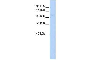 WB Suggested Anti-ZBTB11 Antibody Titration:  0. (ZBTB11 Antikörper  (N-Term))