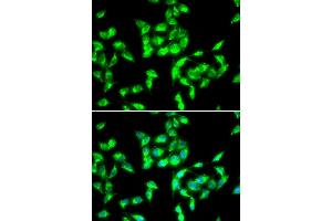 Immunofluorescence analysis of HeLa cells using ANTXR1 antibody. (ANTXR1 Antikörper)